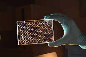 Le laboratoire d'excellence Transplantex a été créé en 2013. / Document remis